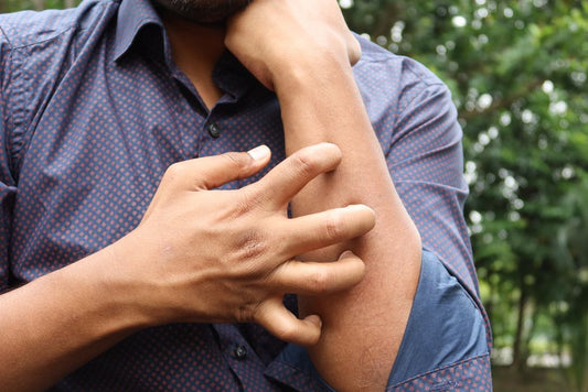 Eczema and Psoriasis Relief for Beginners: A Complete Guide to Soothing Irritated Skin