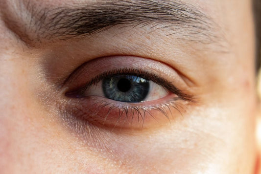 How to Treat Dry Eyes Naturally and When to See a Doctor