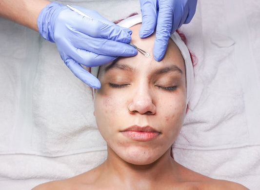 The 10-Minute Acne Routine for Busy Professionals: Streamlined Steps That Actually Work