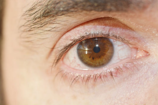 Essential Dry Eye Care System for Men: A Practical Guide to Relief and Prevention