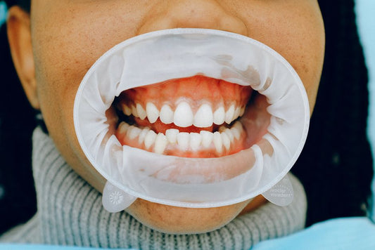 The Dry Mouth-Gum Health Connection: A Complete Guide to Hydrated Gums