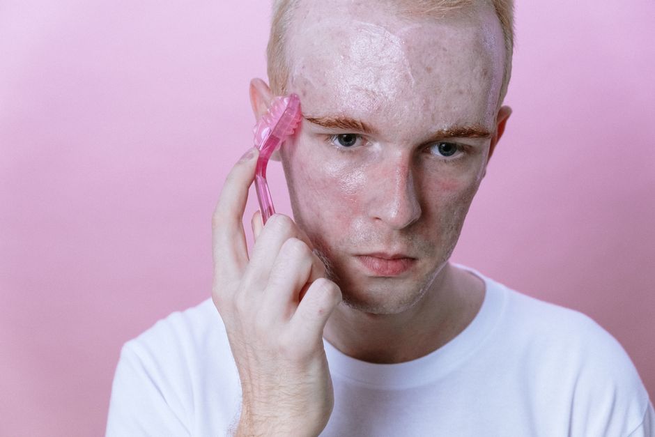 The Step-by-Step Guide to Rescuing Acne-Prone Skin After Routine Failure