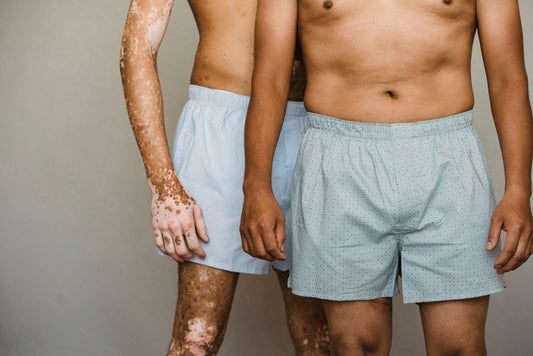 The Essential Guide to Eczema and Psoriasis Relief for Men: A Practical System for Managing Flare-Ups and Restoring Skin Comfort