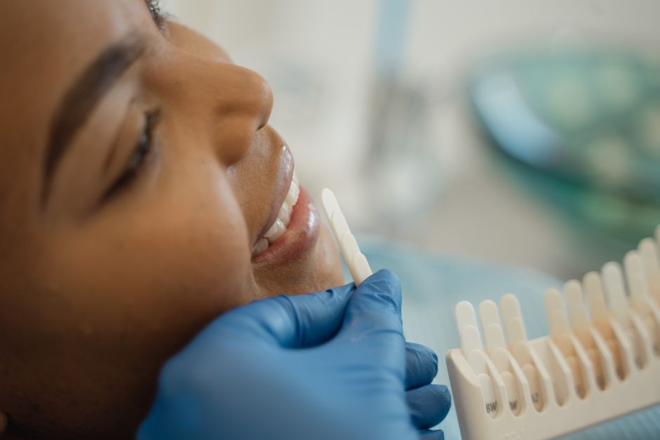 The Complete Grooming Guide: Teeth Whitening for Men