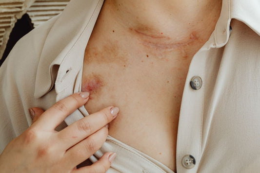 Dermatologist Tips for Wound Healing Without Scarring