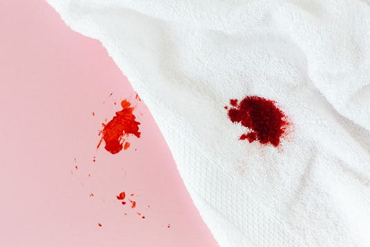 How to Remove Yellow Sweat Stains from White Shirts Without Bleach