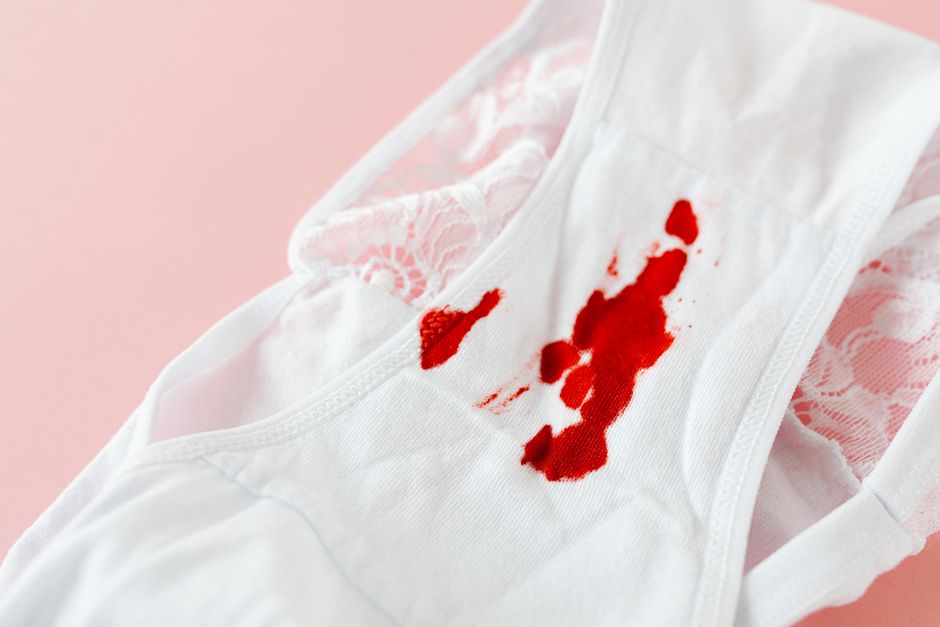 How to Remove Set-In Ketchup Stains from White Cotton Shirts Using Vinegar and Baking Soda