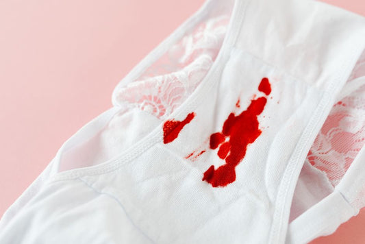 How to Remove Set-In Ketchup Stains from White Cotton Shirts Using Vinegar and Baking Soda